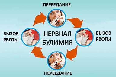 Лечение булимии в Щёкино